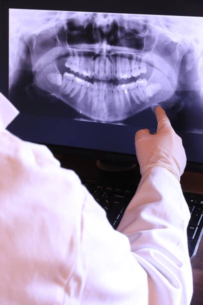 Best Emergency Root Canal Treatment in Heath, TX