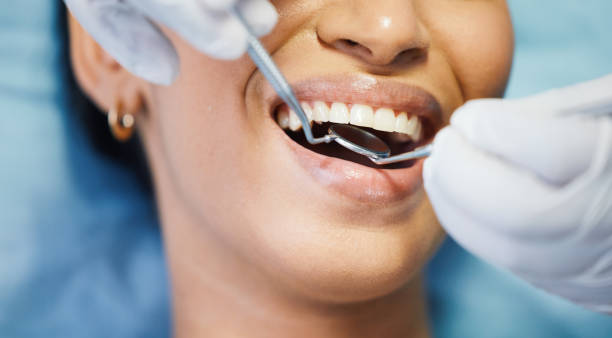 Best Emergency Dentist for Lost Fillings or Crowns in Heath, TX
